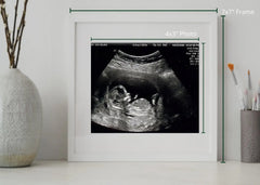 Ultrasound sonogram picture frame 4x3 inch 7x7